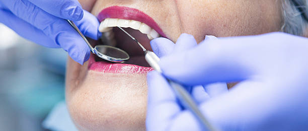 Best Emergency Care for Gum Disease in Cedaredge, CO